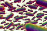 E.coli Outbreak UK, E.coli Outbreak UK, all about e coli outbreak in the united kingdom, Boots