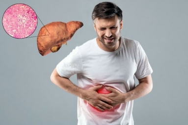 All about Fatty Liver in Non-Drinkers All about Fatty Liver in Non-Drinkers