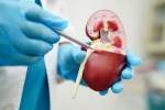 Lower Creatinine Levels for health, Creatinine Levels new tips, tips to lower your creatinine levels, Creatinine levels