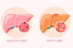 Grade 2 Fatty Liver health, Grade 2 Fatty Liver medication, how to reverse grade 2 fatty liver, Making Grade 2 Fatty Liver health, Grade 2 Fatty Liver medication, how to reverse grade 2 fatty liver, Making