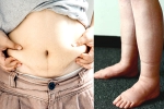 Water Retention food, Water Retention reports, some effective ways to reduce water retention, Heart diseases