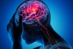 Canada Brain Disease breaking news, Canada Brain Disease cause, canada is hit by a mysterious brain disease, Urologist