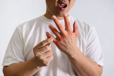 Why joint pains become Worse in Monsoon? Why joint pains become Worse in Monsoon?