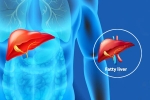Fatty Liver Disease News updates, Fatty Liver Disease News health, body organs that can be affected by fatty liver disease, Excessive drinking Fatty Liver Disease News updates, Fatty Liver Disease News health, body organs that can be affected by fatty liver disease, Excessive drinking
