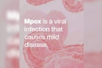 mpox in Sweden, mpox in Africa, mpox emergency again, Congo